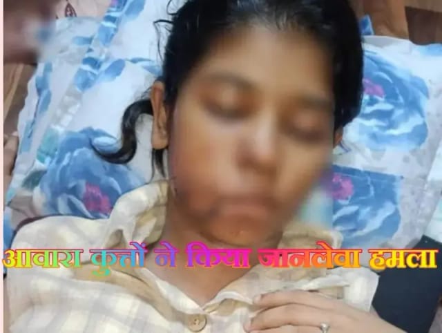  कानपुर के श्याम नगर में कॉलेज से लौट रही बीबीए छात्रा पर आवारा कुत्तों ने किया जानलेवा हमला
